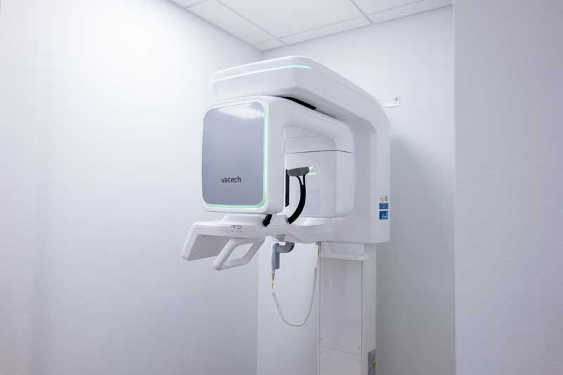 CBCT 3D digital X-rays used at Diamond Dental Group